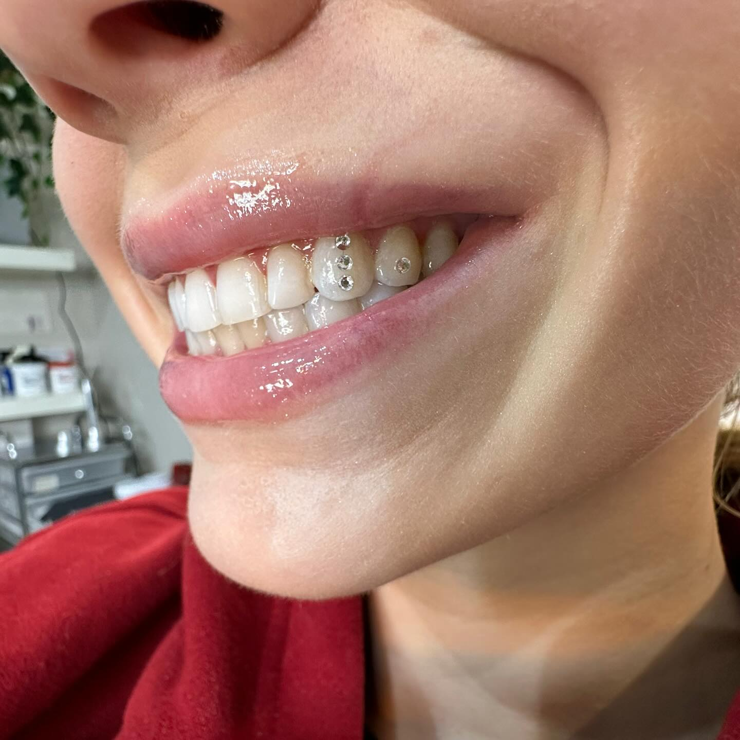 Client smile with subtle gems