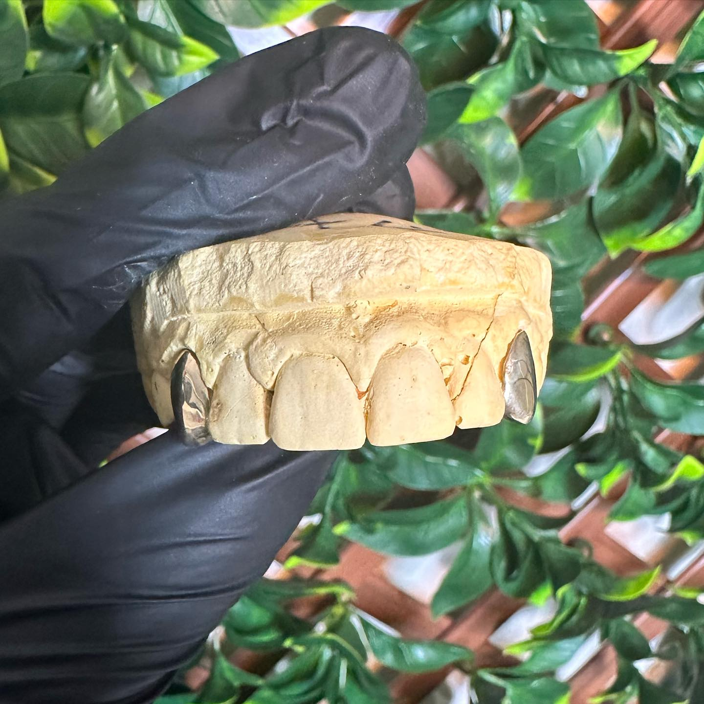 Custom dental mold in black glove